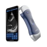 Hand-Held Ultrasound System 2