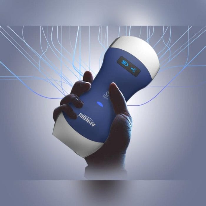 Hand-Held Ultrasound System 7