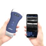 Hand-Held Ultrasound System 9