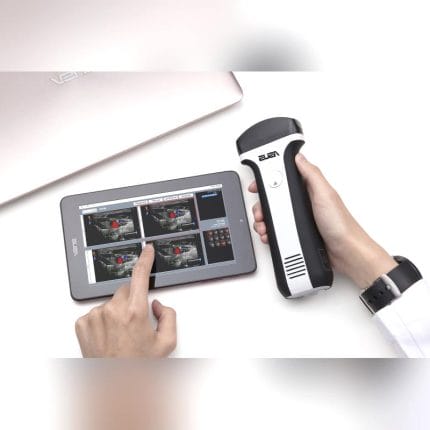 Hand-Held Ultrasound System 1