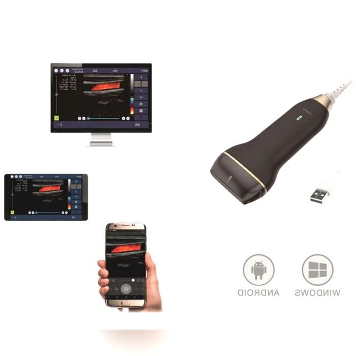 Hand-Held Ultrasound System 1