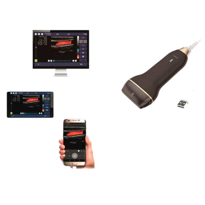 Hand-Held Ultrasound System