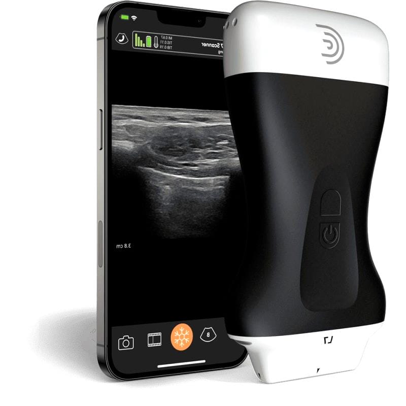 Hand-Held Ultrasound System