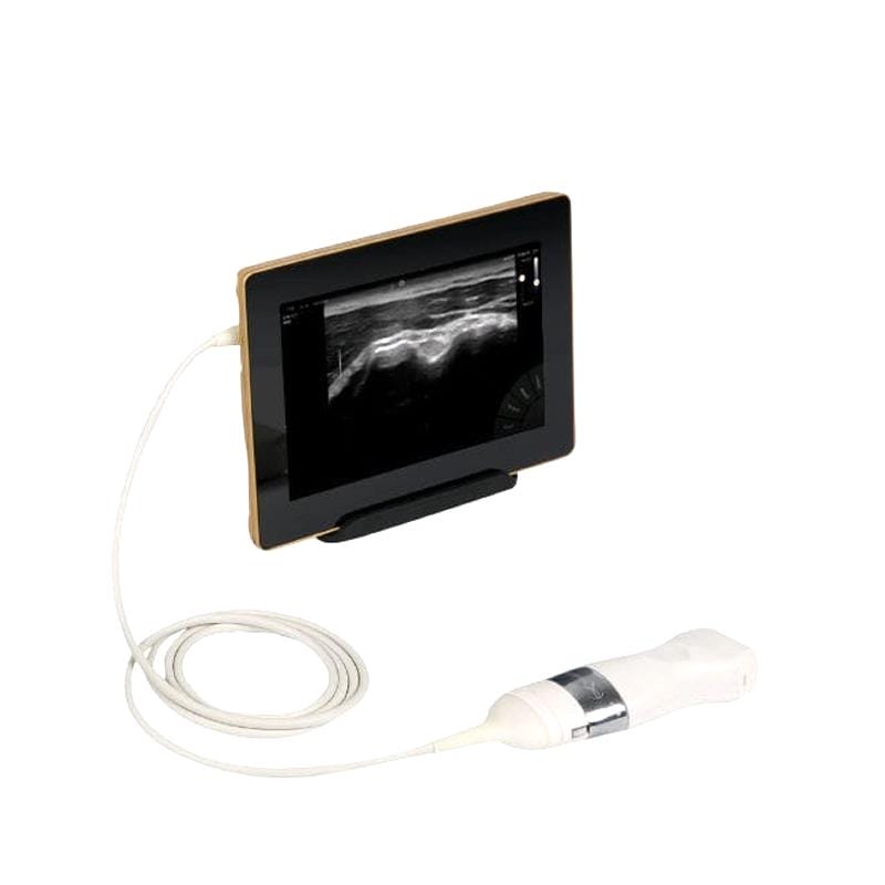 Hand-Held Ultrasound System 1