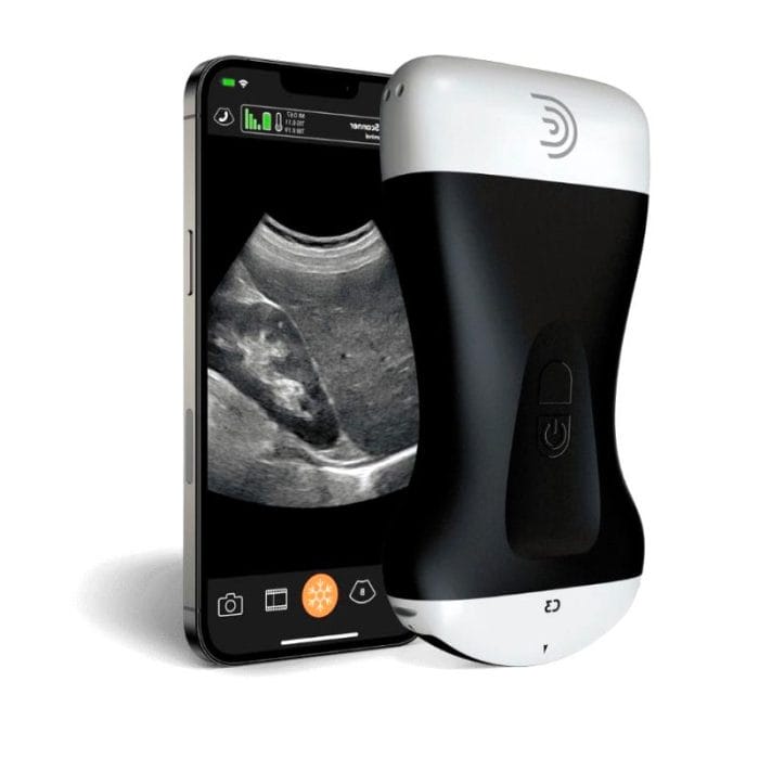 Hand-Held Ultrasound System