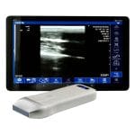 Hand-Held Ultrasound System