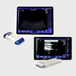 Hand-Held Ultrasound System 2