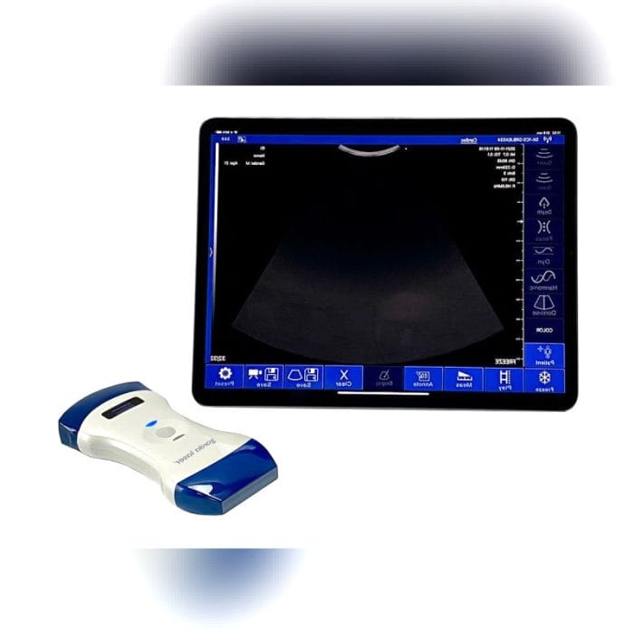 Hand-Held Ultrasound System 3