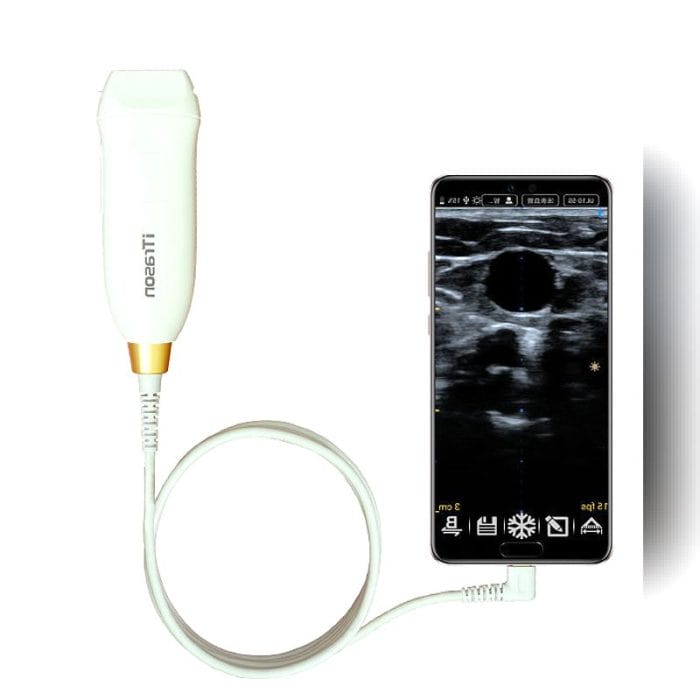 Hand-Held Ultrasound System 1