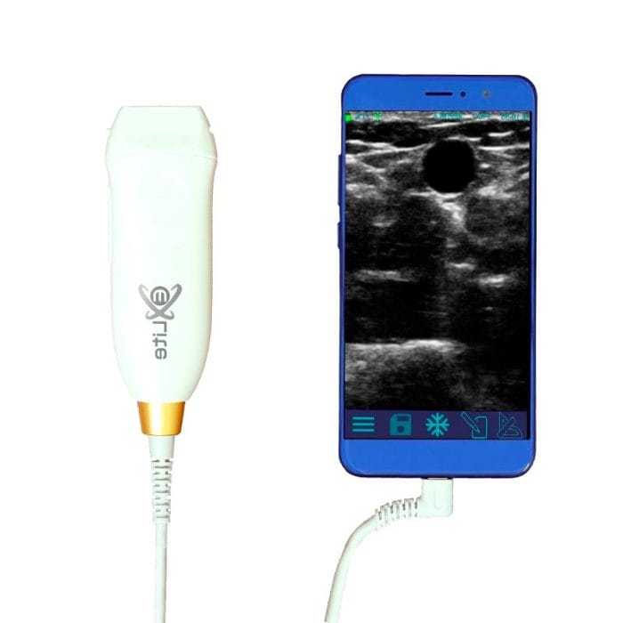 Hand-Held Ultrasound System 2