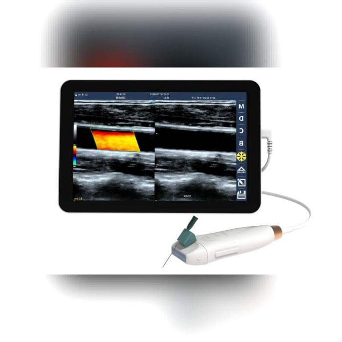 Hand-Held Ultrasound System 3