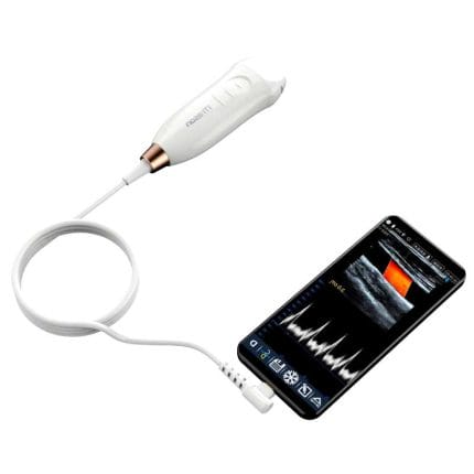 Hand-Held Ultrasound System