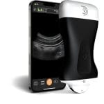 Hand-Held Ultrasound System