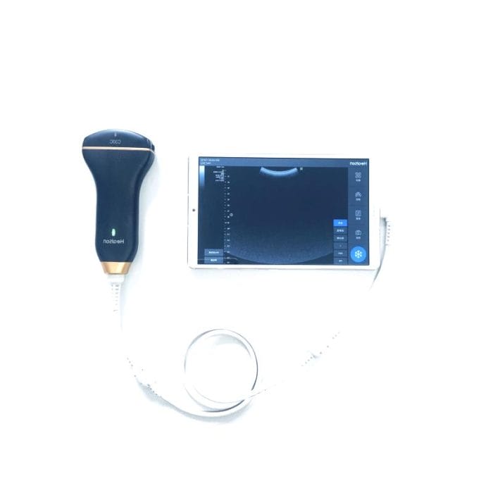 Hand-Held Ultrasound System 4