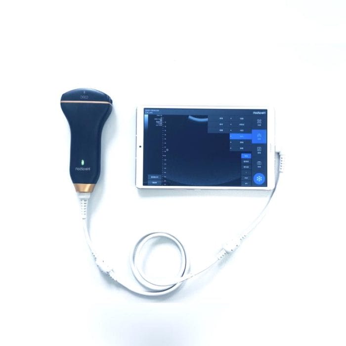 Hand-Held Ultrasound System 5