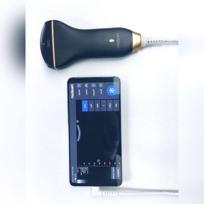 Hand-Held Ultrasound System 9