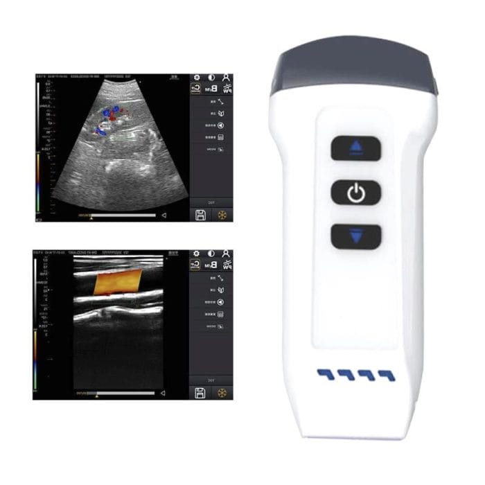 Hand-Held Ultrasound System 1