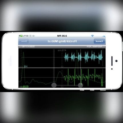 Heart And Lung Sound Converter 1