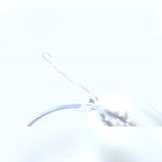 Hemodialysis Catheter 2