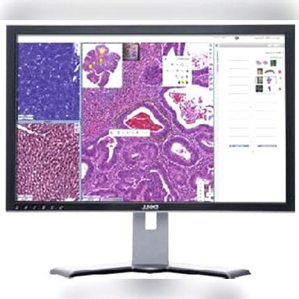 Histopathology Laboratory Software 1