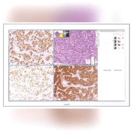 Histopathology Laboratory Software