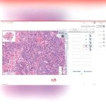 Histopathology Laboratory Software 5