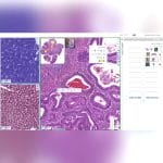 Histopathology Laboratory Software 8