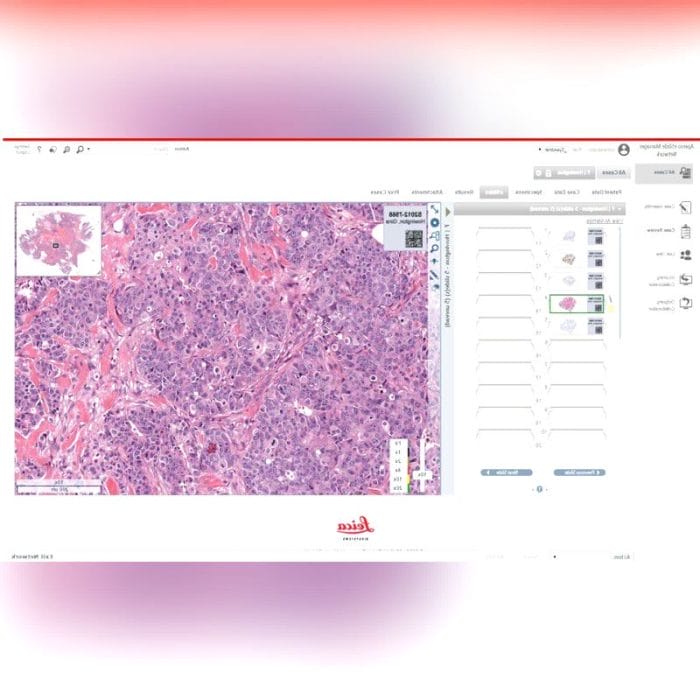 Histopathology Laboratory Software 9