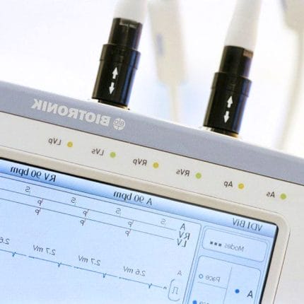 Implantable Cardiac Stimulator Programming Unit 1