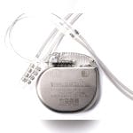 Implantable Neurostimulator 1