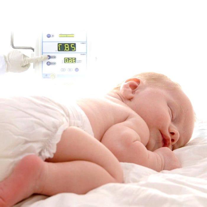 Infant Radiant Warmer With Phototherapy Lamp 1