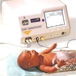 Infant Temperature Monitor And Regulator 2