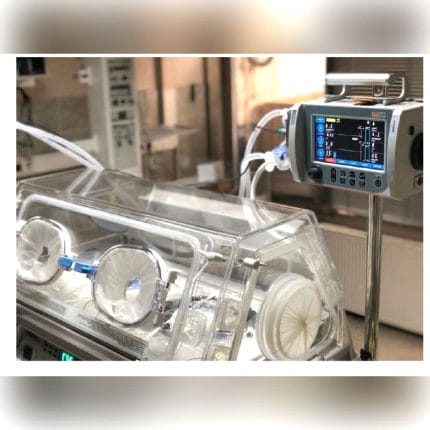 Intensive Care Ventilator