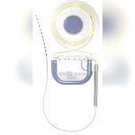 Internal Component Cochlear Implant 6