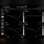 Intraoperative Nerve Monitoring System 6