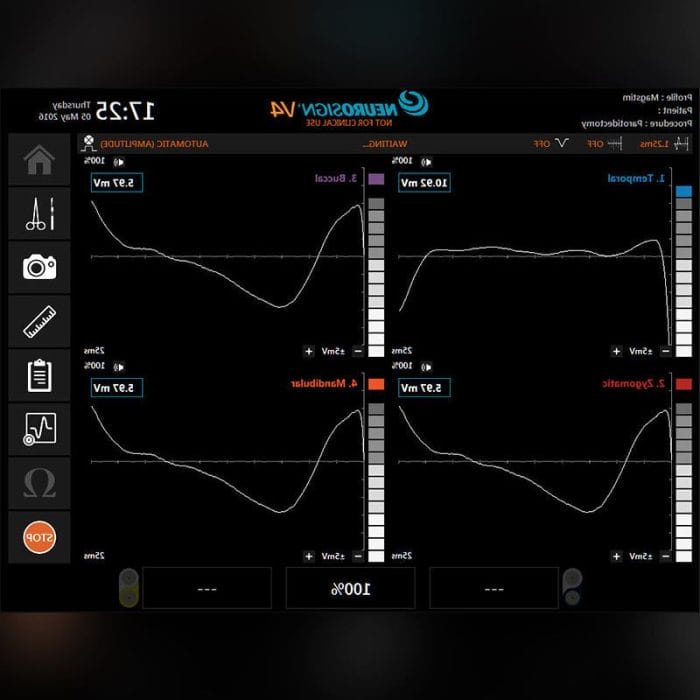 Intraoperative Nerve Monitoring System 6