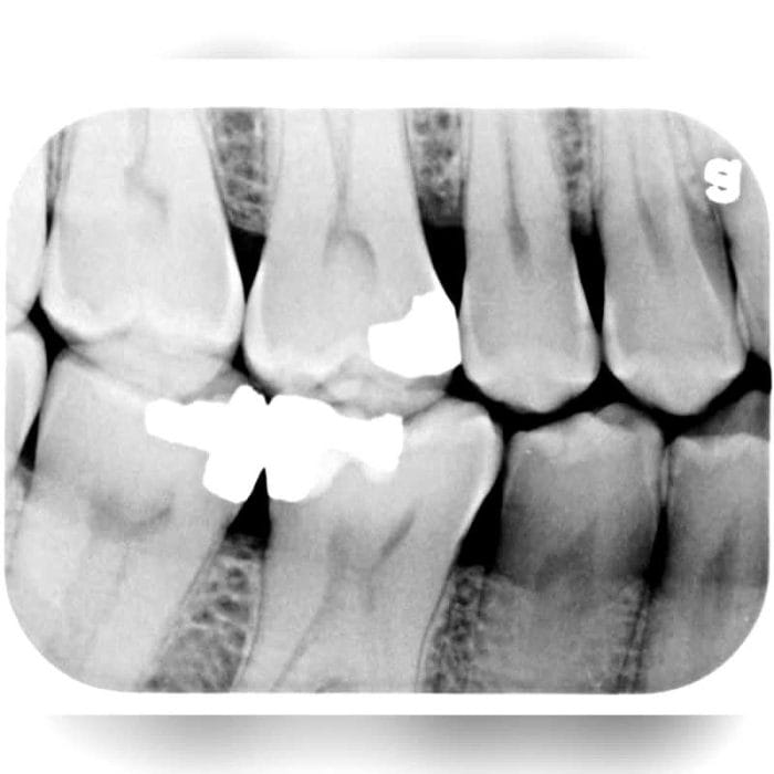 Intraoral Cr Scanner 8