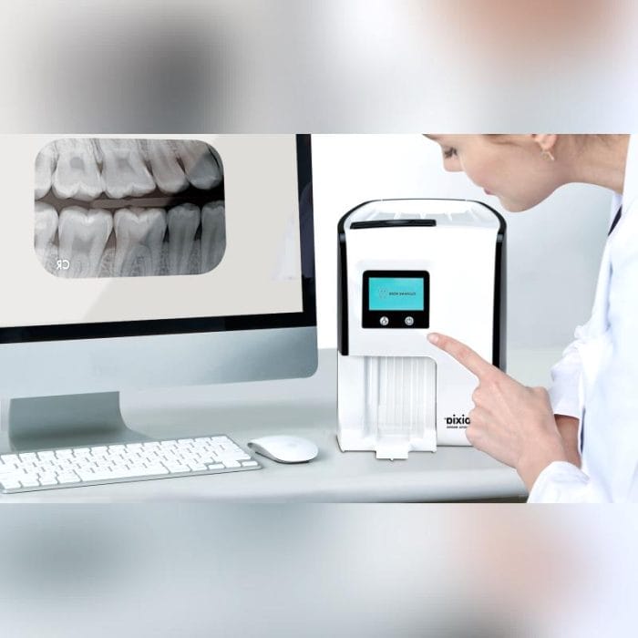 Intraoral Cr Scanner 1