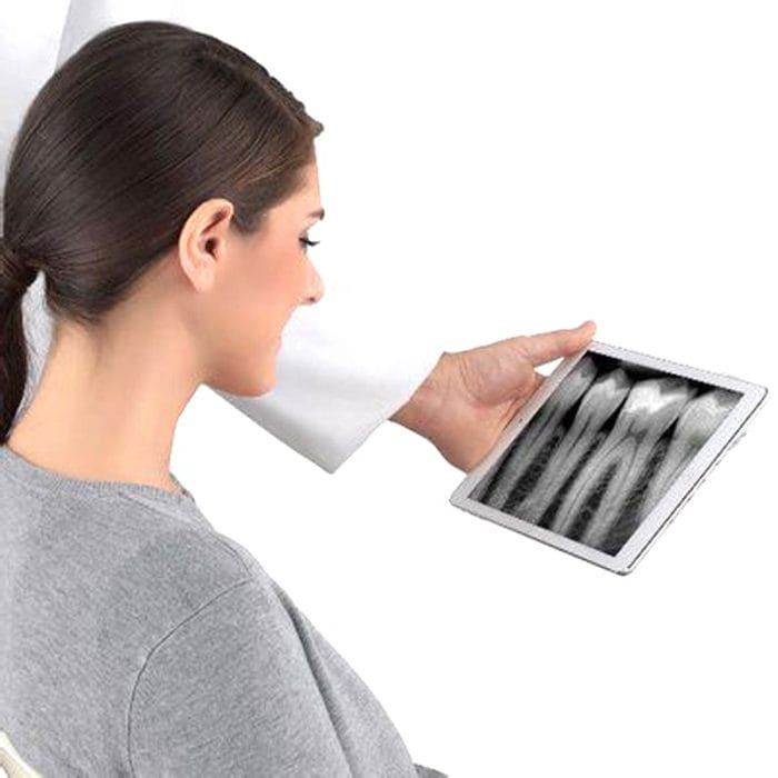 Intraoral Cr Scanner 2