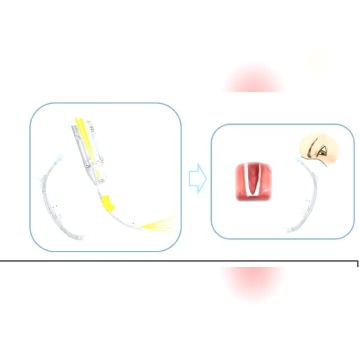 Laryngoscope 7