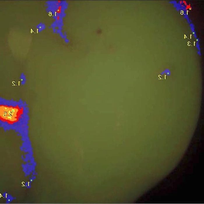 Laser Fluorescence Caries Detector 7