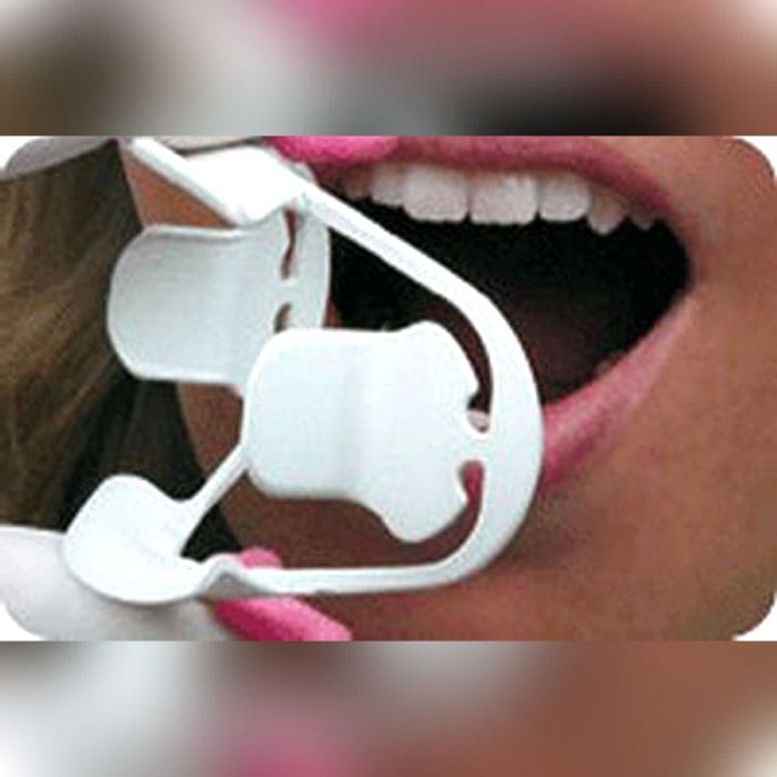 Lip Retractor 2