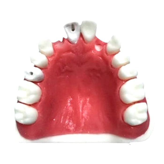 Maxilla Anatomical Model