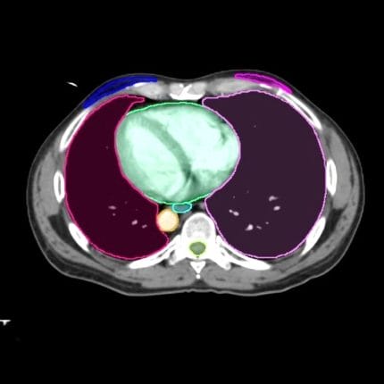 Medical Imaging Ai Platform