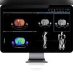 Medical Imaging Pacs