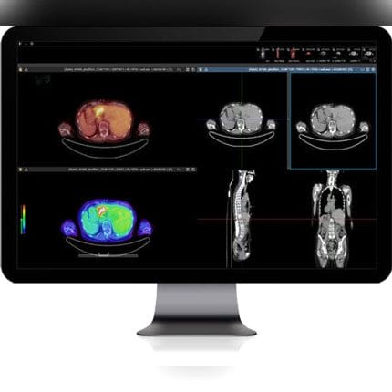 Medical Imaging Pacs