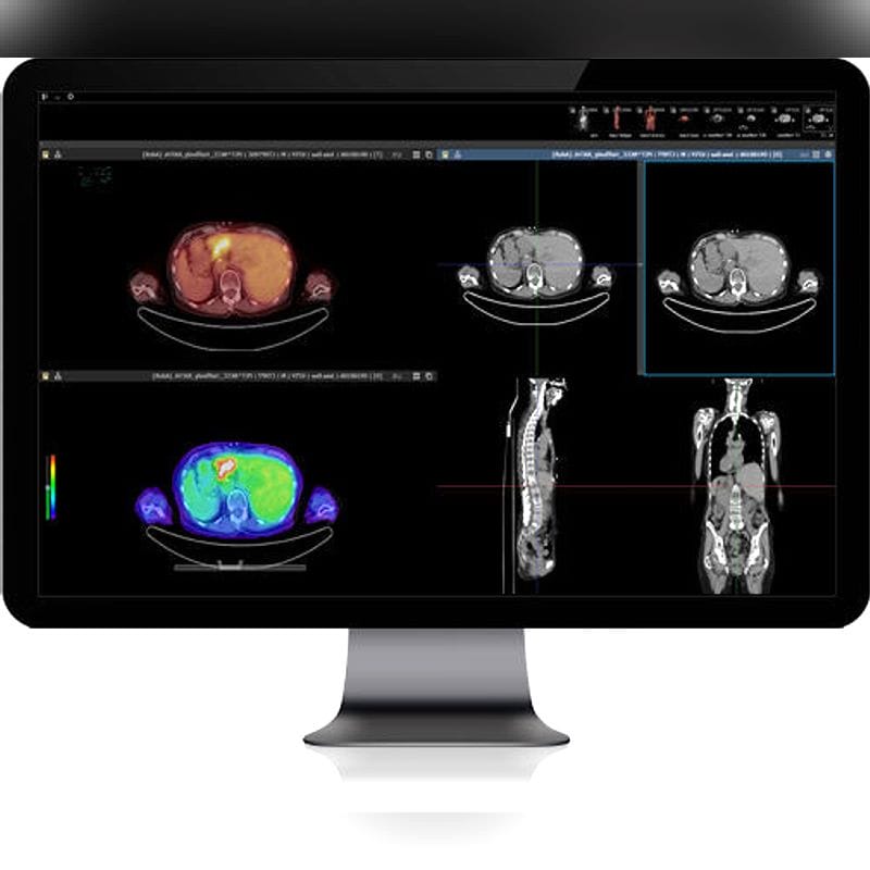 Medical Imaging Pacs