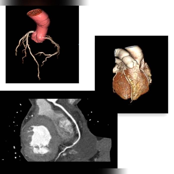 Medical Imaging Ris 2