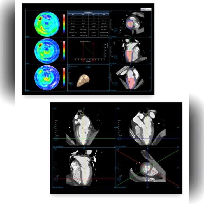 Medical Imaging Ris 3