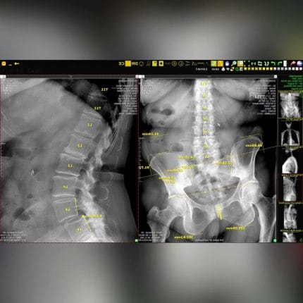 Medical Imaging Transmission System 1